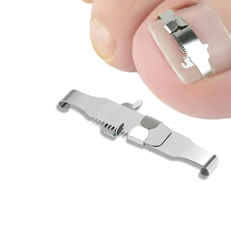 Orthopedic Buckle Toe Nail Groove Ingrown Nail Corrector, No. 36 Positive Nail Buckle, No. 38 Positive Nail Buckle, No. 40 Positive Nail Buckle, No. 42 Positive Nail Buckle, No. 44 Positive Nail Buckle, No. 36 Set, No. 38 Set, No. 40 Set, No. 42 Set