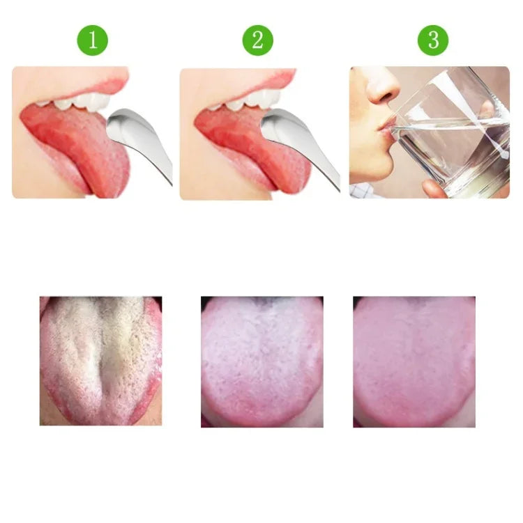 Tongue Cleaner Bad Breath Stainless Steel Cleaning Brush Tongue Scraper + Two-piece Set (Rose Gold ), Tongue Scraper+Two-piece Set (Silver ), Tongue Scraper + Two-piece Set (Rose Gold )